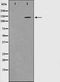 Western blot analysis on mouse brain cell lysate using Phospho-PYK2(Tyr580) Antibody.The lane on the left is treated with the antigen-specific peptide.