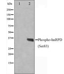 Western blot analysis on HuvEc cell lysate using Phospho-hnRPD(Ser83) Antibody,The lane on the left is treated with the antigen-specific peptide.