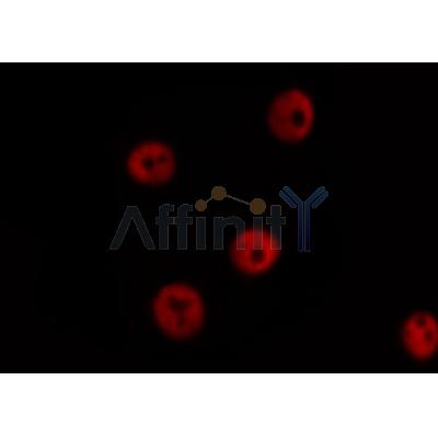 AF0033 staining HuvEc by IF/ICC. The sample were fixed with PFA and permeabilized in 0.1% Triton X-100,then blocked in 10% serum for 45 minutes at 25¡ãC. The primary antibody was diluted at 1/200 and incubated with the sample for 1 hour at 37¡ãC. An  Alexa Fluor 594 conjugated goat anti-rabbit IgG (H+L) Ab, diluted at 1/600, was used as the secondary antibod