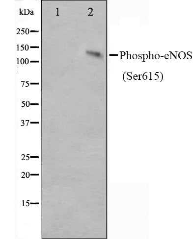 Western blot analysis on K562 cell lysate using Phospho-eNOS(Ser615) Antibody.The lane on the left is treated with the antigen-specific peptide.