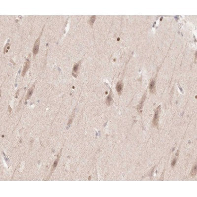 AF0160 at 1/100 staining human brain tissue sections by IHC-P. The tissue was formaldehyde fixed and a heat mediated antigen retrieval step in citrate buffer was performed. The tissue was then blocked and incubated with the antibody for 1.5 hours at 22¡ãC. An HRP conjugated goat anti-rabbit antibody was used as the secondary