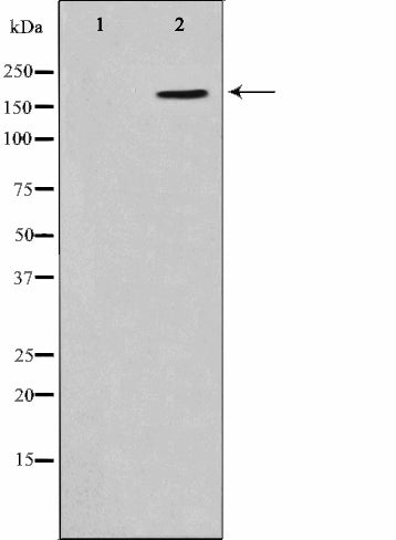Western blot analysis on HepG2 cell lysate using Phospho-CD227/MUC1(Tyr1229) Antibody.The lane on the left is treated with the antigen-specific peptide.