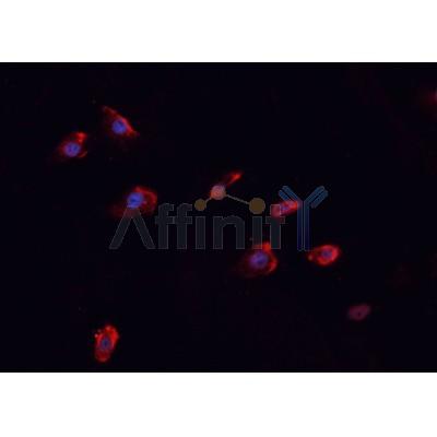 AF0037 staining MCF-7 cells by IF/ICC. The sample were fixed with PFA and permeabilized in 0.1% Triton X-100,then blocked in 10% serum for 45 minutes at 25¡ãC. The primary antibody was diluted at 1/200 and incubated with the sample for 1 hour at 37¡ãC. An  Alexa Fluor 594 conjugated goat anti-rabbit IgG (H+L) antibody(Cat.
