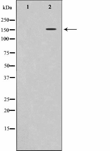 Western blot analysis on K562 cell lysate using Phospho-VEGFR2(Tyr1214) Antibody.The lane on the left is treated with the antigen-specific peptide.