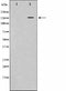 Western blot analysis on K562 cell lysate using Phospho-VEGFR2(Tyr1214) Antibody.The lane on the left is treated with the antigen-specific peptide.