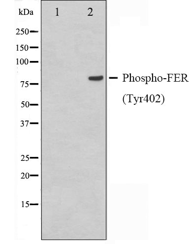 Western blot analysis on Jurkat cell lysate using Phospho-FER(Tyr402) Antibody.The lane on the left is treated with the antigen-specific peptide.
