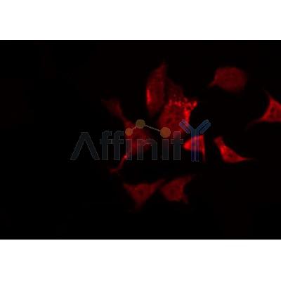 AF0044 staining Hela by IF/ICC. The sample were fixed with PFA and permeabilized in 0.1% Triton X-100,then blocked in 10% serum for 45 minutes at 25¡ãC. The primary antibody was diluted at 1/200 and incubated with the sample for 1 hour at 37¡ãC. An  Alexa Fluor 594 conjugated goat anti-rabbit IgG (H+L) Ab, diluted at 1/600, was used as the secondary antibod
