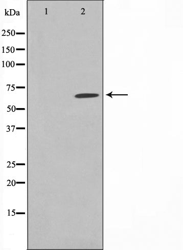 Western blot analysis on rat heart cell lysate using Phospho-PAK3(Ser154) Antibody.The lane on the left is treated with the antigen-specific peptide.