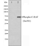 Western blot analysis on Jurkat cell lysate using Phospho-C-RAF(Ser301) Antibody.The lane on the left is treated with the antigen-specific peptide.