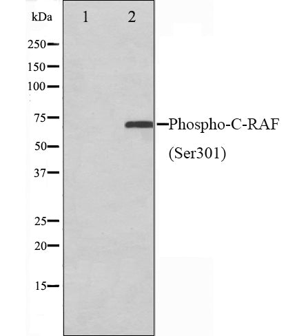 Western blot analysis on Jurkat cell lysate using Phospho-C-RAF(Ser301) Antibody.The lane on the left is treated with the antigen-specific peptide.