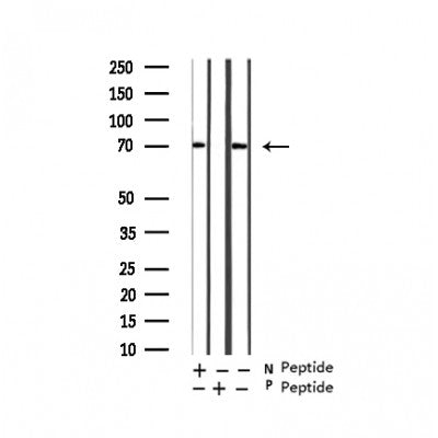 Western blot analysis on 293 cell lysate using Phospho-RIPK2(Ser176) Antibody