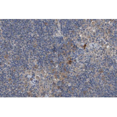 AF0049 at 1/200 staining human lymph node tissue sections by IHC-P. The tissue was formaldehyde fixed and a heat mediated antigen retrieval step in citrate buffer was performed. The tissue was then blocked and incubated with the antibody for 1.5 hours at 22¡ãC. An HRP conjugated goat anti-rabbit antibody was used as the secondary