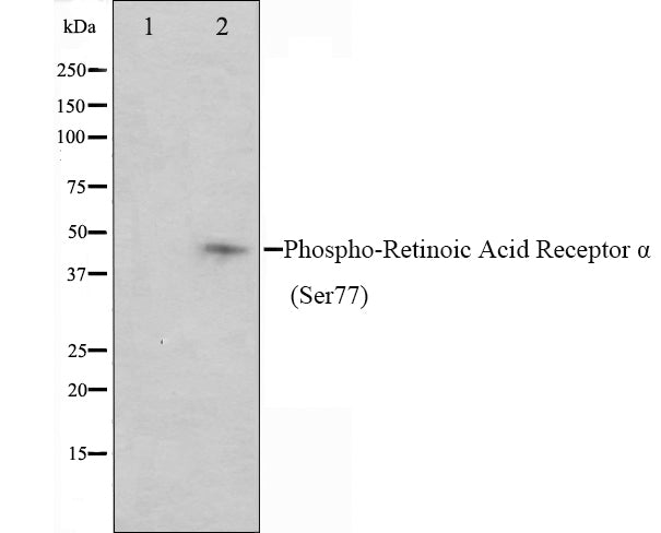 Western blot analysis on Jurkat cell lysate using Phospho-Retinoic Acid Receptor alpha (Ser77) Antibody,The lane on the left is treated with the antigen-specific peptide.
