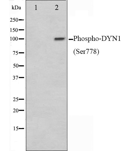 Western blot analysis on mouse brain cell lysate using Phospho-DYN1(Ser778) Antibody,The lane on the left is treated with the antigen-specific peptide.