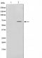 Western blot analysis on HeLa cell lysate using Phospho-Paxillin(Ser178) Antibody,The lane on the left is treated with the antigen-specific peptide.