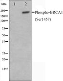 Western blot analysis on 293 cell lysate using Phospho-BRCA1(Ser1457) Antibody,The lane on the left is treated with the antigen-specific peptide.