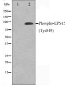 Western blot analysis on HepG2 cell lysate using Phospho-EPS15(Tyr849) Antibody,The lane on the left is treated with the antigen-specific peptide.