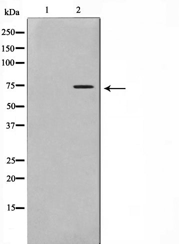 Western blot analysis on HT29 cell lysate using Phospho-Gab2(Tyr452) Antibody,The lane on the left is treated with the antigen-specific peptide.