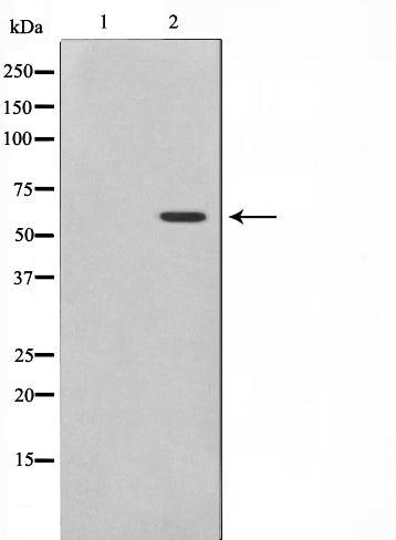 Western blot analysis on K562 cell lysate using Phospho-MAPKAPK5(Thr182) Antibody,The lane on the left is treated with the antigen-specific peptide.