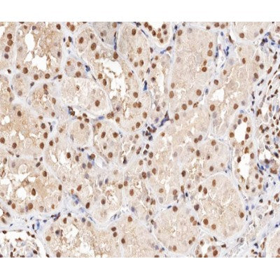 AF0060 at 1/200 staining human kidney tissue sections by IHC-P. The tissue was formaldehyde fixed and a heat mediated antigen retrieval step in citrate buffer was performed. The tissue was then blocked and incubated with the antibody for 1.5 hours at 22¡ãC. An HRP conjugated goat anti-rabbit antibody was used as the secondary