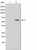 Western blot analysis on K562 cell lysate using Phospho-MAPKAPK5(Thr182) Antibody,The lane on the left is treated with the antigen-specific peptide.