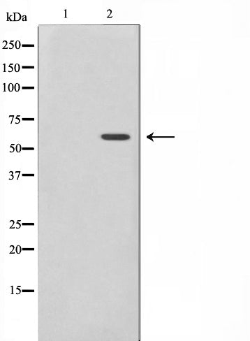 Western blot analysis on K562 cell lysate using Phospho-MAPKAPK5(Thr182) Antibody,The lane on the left is treated with the antigen-specific peptide.