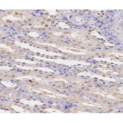 AF0061 at 1/200 staining human kidney tissue sections by IHC-P. The tissue was formaldehyde fixed and a heat mediated antigen retrieval step in citrate buffer was performed. The tissue was then blocked and incubated with the antibody for 1.5 hours at 22¡ãC. An HRP conjugated goat anti-rabbit antibody was used as the secondary