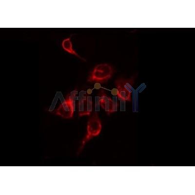 AF0211 staining A549 by IF/ICC. The sample were fixed with PFA and permeabilized in 0.1% Triton X-100,then blocked in 10% serum for 45 minutes at 25¡ãC. The primary antibody was diluted at 1/200 and incubated with the sample for 1 hour at 37¡ãC. An  Alexa Fluor 594 conjugated goat anti-rabbit IgG (H+L) Ab, diluted at 1/600, was used as the secondary antibod