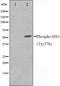 Western blot analysis on HepG2 cell lysate using Phospho-HS1(Tyr378) Antibody,The lane on the left is treated with the antigen-specific peptide.