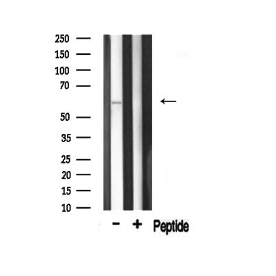 AF0832 staining 293 by IF/ICC. The sample were fixed with PFA and permeabilized in 0.1% Triton X-100,then blocked in 10% serum for 45 minutes at 25¡ãC. The primary antibody was diluted at 1/200 and incubated with the sample for 1 hour at 37¡ãC. An  Alexa Fluor 594 conjugated goat anti-rabbit IgG (H+L) Ab, diluted at 1/600, was used as the secondary antibod