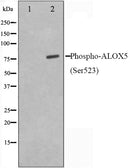 Western blot analysis on HuvEc cell lysate using Phospho-ALOX5(Ser523) Antibody,The lane on the left is treated with the antigen-specific peptide.