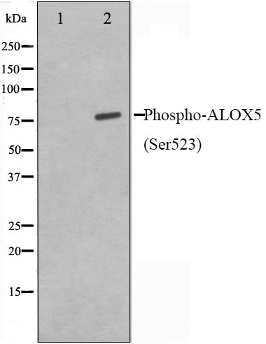 Western blot analysis on HuvEc cell lysate using Phospho-ALOX5(Ser523) Antibody,The lane on the left is treated with the antigen-specific peptide.