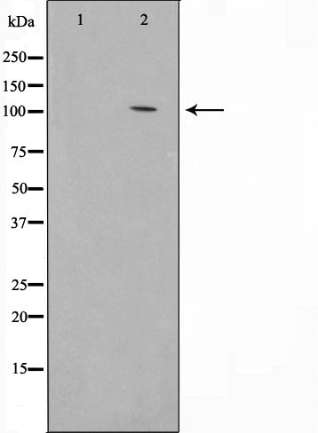Western blot analysis on JK cell lysate using Phospho-VAV3(Tyr173) Antibody,The lane on the left is treated with the antigen-specific peptide.