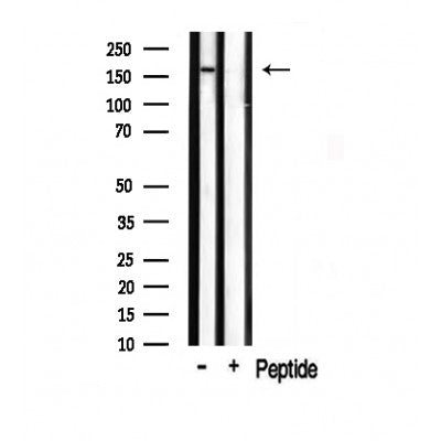 AF0793 staining Hela by IF/ICC. The sample were fixed with PFA and permeabilized in 0.1% Triton X-100,then blocked in 10% serum for 45 minutes at 25¡ãC. The primary antibody was diluted at 1/200 and incubated with the sample for 1 hour at 37¡ãC. An  Alexa Fluor 594 conjugated goat anti-rabbit IgG (H+L) Ab, diluted at 1/600, was used as the secondary antibod