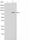 AF0828 staining HuvEc by IF/ICC. The sample were fixed with PFA and permeabilized in 0.1% Triton X-100,then blocked in 10% serum for 45 minutes at 25¡ãC. The primary antibody was diluted at 1/200 and incubated with the sample for 1 hour at 37¡ãC. An  Alexa Fluor 594 conjugated goat anti-rabbit IgG (H+L) Ab, diluted at 1/600, was used as the secondary antibod