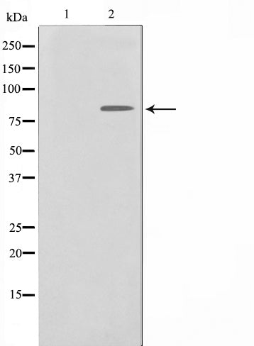 AF0828 staining HuvEc by IF/ICC. The sample were fixed with PFA and permeabilized in 0.1% Triton X-100,then blocked in 10% serum for 45 minutes at 25¡ãC. The primary antibody was diluted at 1/200 and incubated with the sample for 1 hour at 37¡ãC. An  Alexa Fluor 594 conjugated goat anti-rabbit IgG (H+L) Ab, diluted at 1/600, was used as the secondary antibod