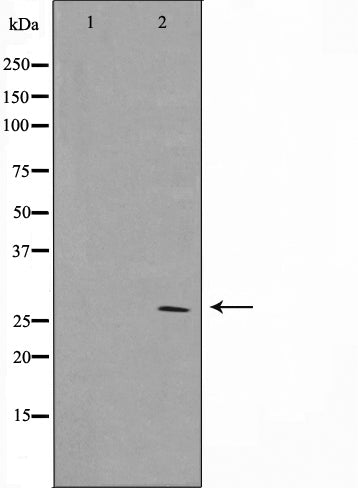 AF0769 staining MCF7 by IF/ICC. The sample were fixed with PFA and permeabilized in 0.1% Triton X-100,then blocked in 10% serum for 45 minutes at 25¡ãC. The primary antibody was diluted at 1/200 and incubated with the sample for 1 hour at 37¡ãC. An  Alexa Fluor 594 conjugated goat anti-rabbit IgG (H+L) Ab, diluted at 1/600, was used as the secondary antibod