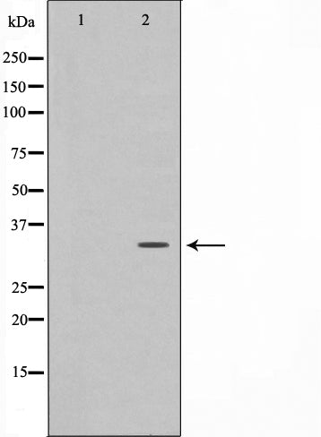 Western blot analysis on A2780 cell lysate using CDC2 Antibody,The lane on the left is treated with the antigen-specific peptide.