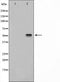 AF0842 staining LOVO by IF/ICC. The sample were fixed with PFA and permeabilized in 0.1% Triton X-100,then blocked in 10% serum for 45 minutes at 25¡ãC. The primary antibody was diluted at 1/200 and incubated with the sample for 1 hour at 37¡ãC. An  Alexa Fluor 594 conjugated goat anti-rabbit IgG (H+L) Ab, diluted at 1/600, was used as the secondary antibod