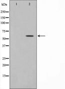 Western blot analysis on HuvEc cell lysate using MMP19 Antibody. The lane on the left is treated with the antigen-specific peptide.