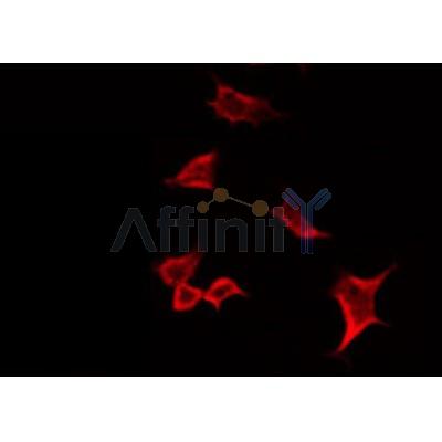 AF0215 staining HuvEc by IF/ICC. The sample were fixed with PFA and permeabilized in 0.1% Triton X-100,then blocked in 10% serum for 45 minutes at 25¡ãC. The primary antibody was diluted at 1/200 and incubated with the sample for 1 hour at 37¡ãC. An  Alexa Fluor 594 conjugated goat anti-rabbit IgG (H+L) Ab, diluted at 1/600, was used as the secondary antibod