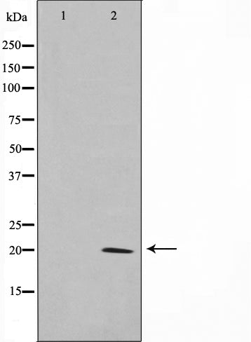 Western blot analysis on mouse brain cell lysate using Claudin 11 Antibody,The lane on the left is treated with the antigen-specific peptide.
