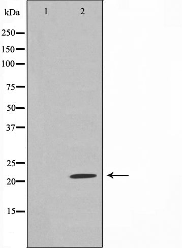 AF0521 at 1/100 staining human lung tissue sections by IHC-P. The tissue was formaldehyde fixed and a heat mediated antigen retrieval step in citrate buffer was performed. The tissue was then blocked and incubated with the antibody for 1.5 hours at 22¡ãC. An HRP conjugated goat anti-rabbit antibody was used as the secondary