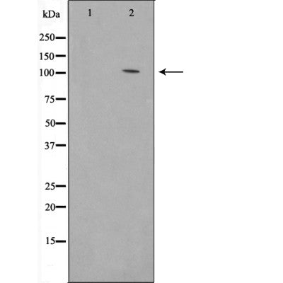 Western blot analysis of Collagen I Antibody expression in Mouse skin tissue lysates.The lane on the left is treated with the antigen-specific peptide.