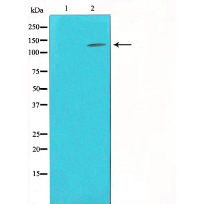 Western blot analysis of extracts from Hela, using Collagen III Antibody.,The lane on the left is treated with the antigen-specific peptide.