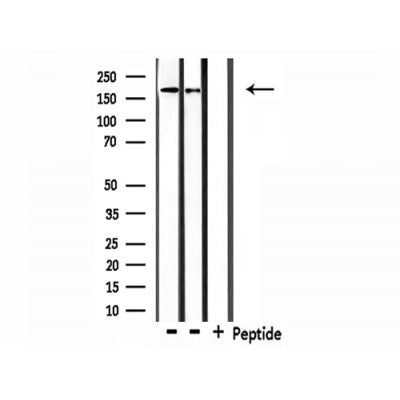 Western blot analysis of extracts from 293 and Hela, using Collagen IV Antibody.