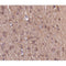 AF0153 at 1/100 staining human brain tissue sections by IHC-P. The tissue was formaldehyde fixed and a heat mediated antigen retrieval step in citrate buffer was performed. The tissue was then blocked and incubated with the antibody for 1.5 hours at 22¡ãC. An HRP conjugated goat anti-rabbit antibody was used as the secondary