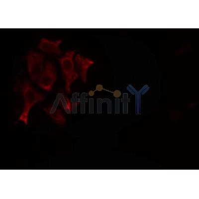 AF0216 staining SKOV3 cells by IF/ICC. The sample were fixed with PFA and permeabilized in 0.1% Triton X-100,then blocked in 10% serum for 45 minutes at 25¡ãC. The primary antibody was diluted at 1/200 and incubated with the sample for 1 hour at 37¡ãC. An  Alexa Fluor 594 conjugated goat anti-rabbit IgG (H+L) antibody(Cat.# S0006), diluted at 1/600, was used as secondary antibod