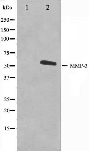 Western blot analysis on 293 cell lysate using MMP3 Antibody. The lane on the left is treated with the antigen-specific peptide.