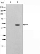 AF0586 staining COLO205 by IF/ICC. The sample were fixed with PFA and permeabilized in 0.1% Triton X-100,then blocked in 10% serum for 45 minutes at 25¡ãC. The primary antibody was diluted at 1/200 and incubated with the sample for 1 hour at 37¡ãC. An  Alexa Fluor 594 conjugated goat anti-rabbit IgG (H+L) Ab, diluted at 1/600, was used as the secondary antibod